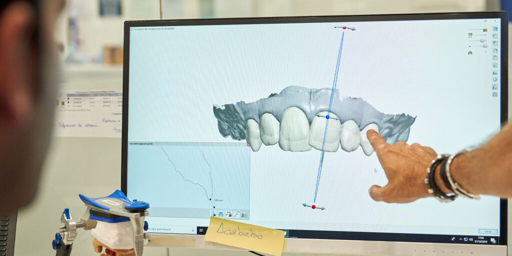 prosthodontist showing dental scan