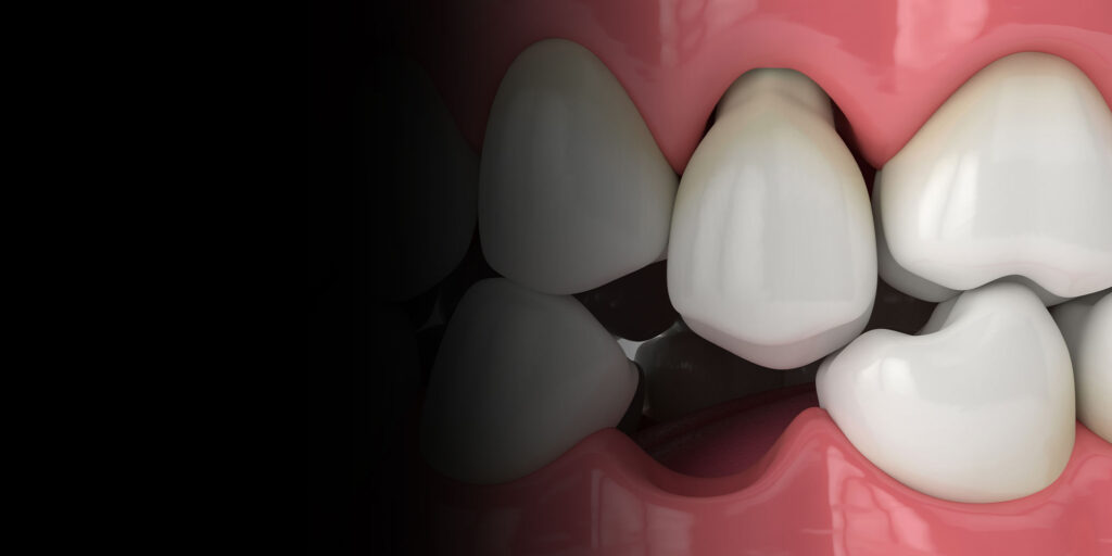 3d illustration of. missing tooth