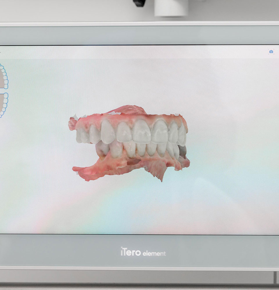 image display of patient mouth within the dental practice