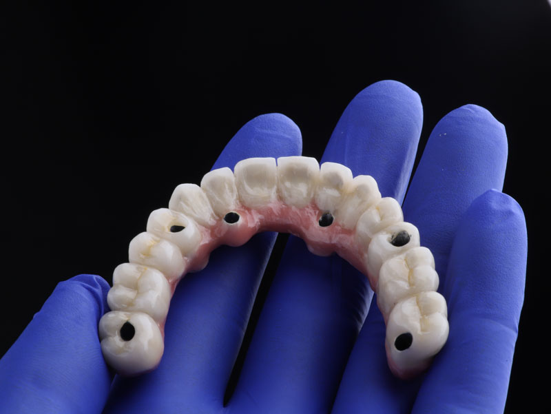 Navigating the World of Dental Implant Surgery in Somerville, MA
