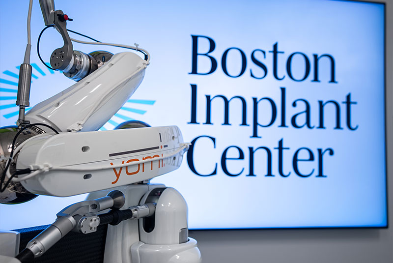 close up yomi robotics machinery