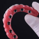 Dental Implants Prosthetic Porcelain Rehabilitation, dentist is holding the model in a dark room with black gloves