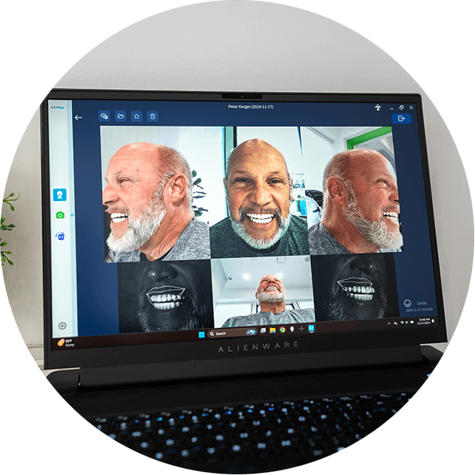 smile design