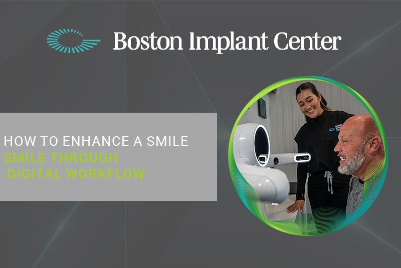 How To Enhance A Smile Through Digital Workflow