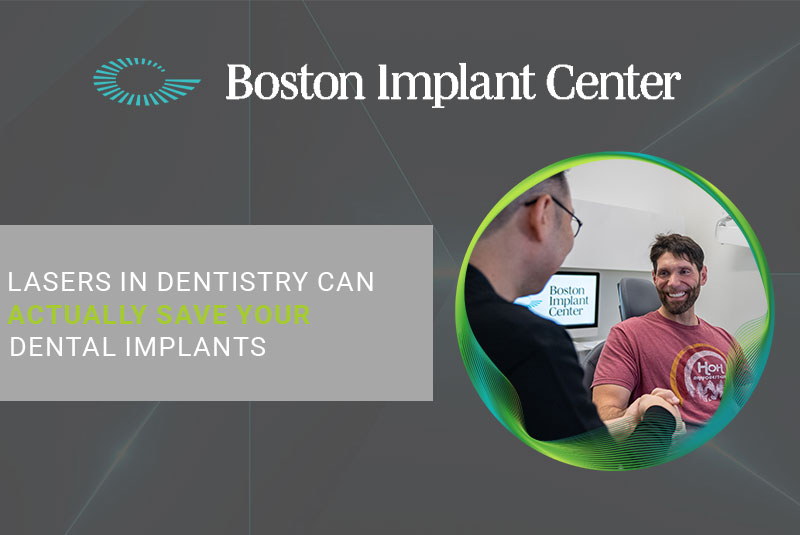 Lasers In Dentistry Can Actually Save Your Dental Implants
